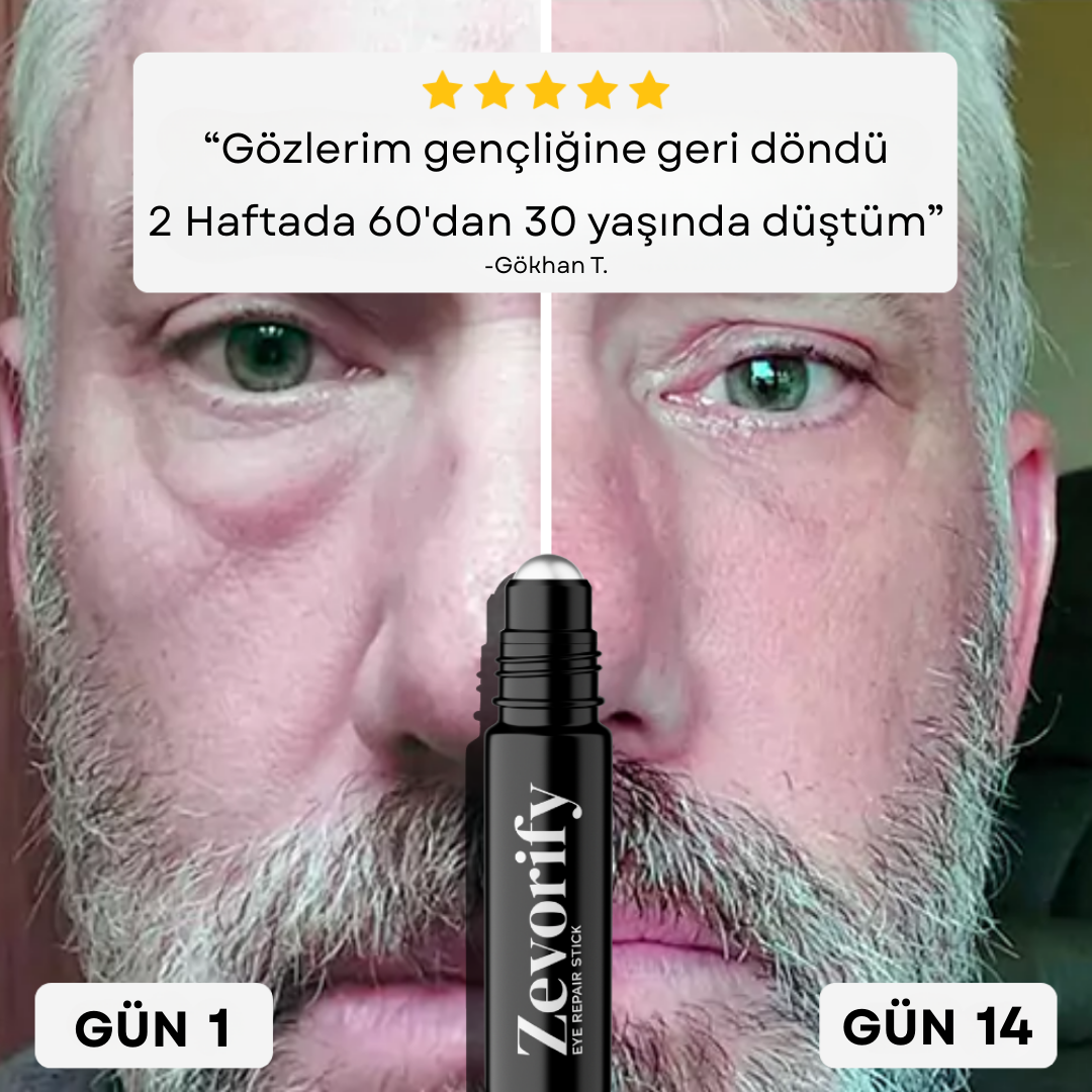 Nevorin Göz Altı Onarım Roll On
