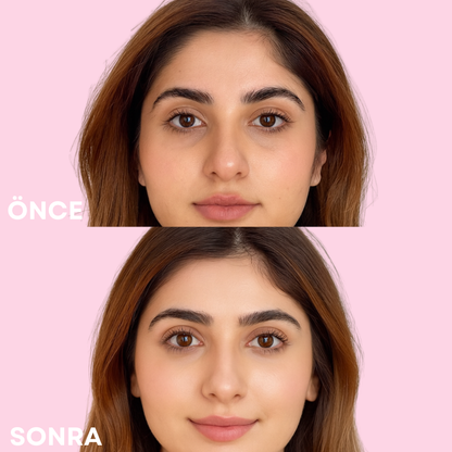 Nevorin Göz Altı Onarıcı